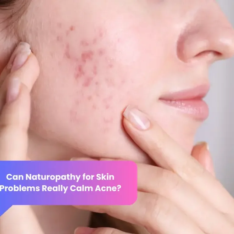 Woman with inflamed facial acne on cheek, illustrating skin condition treated by a naturopath for acne.